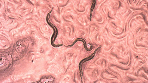 nematode0.jpg